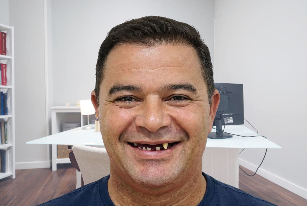 AI Dental Visualization