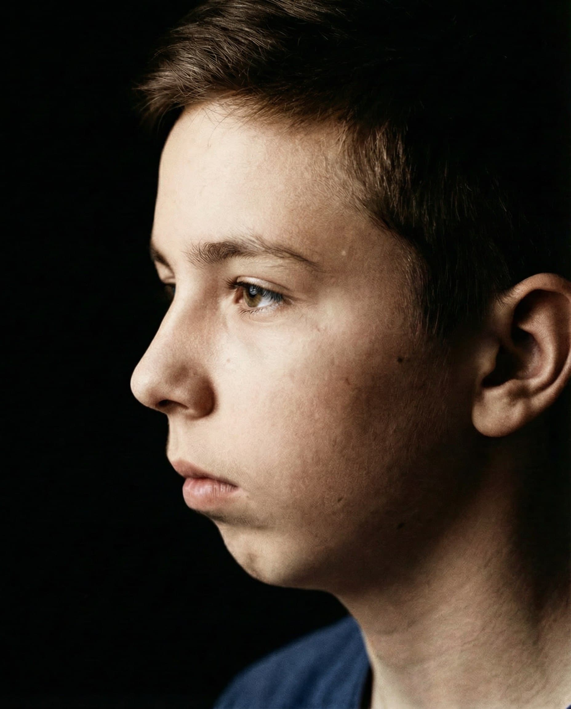 Distal Occlusion Correction before